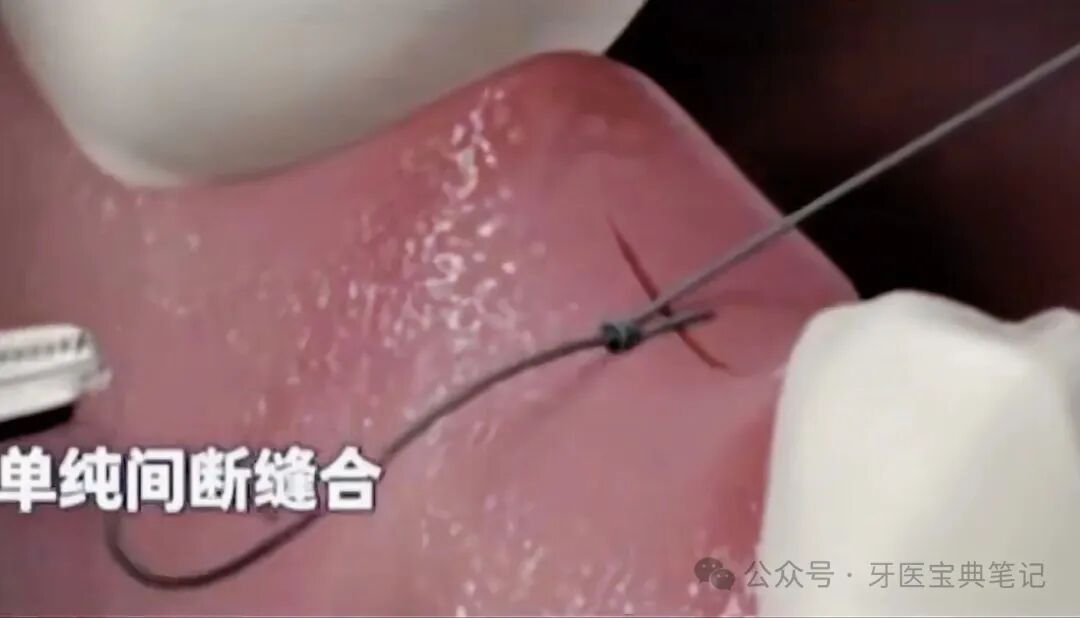 种植实操全流程！不再手忙脚乱～