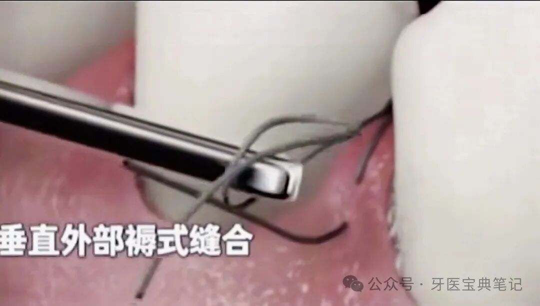种植实操全流程！不再手忙脚乱～