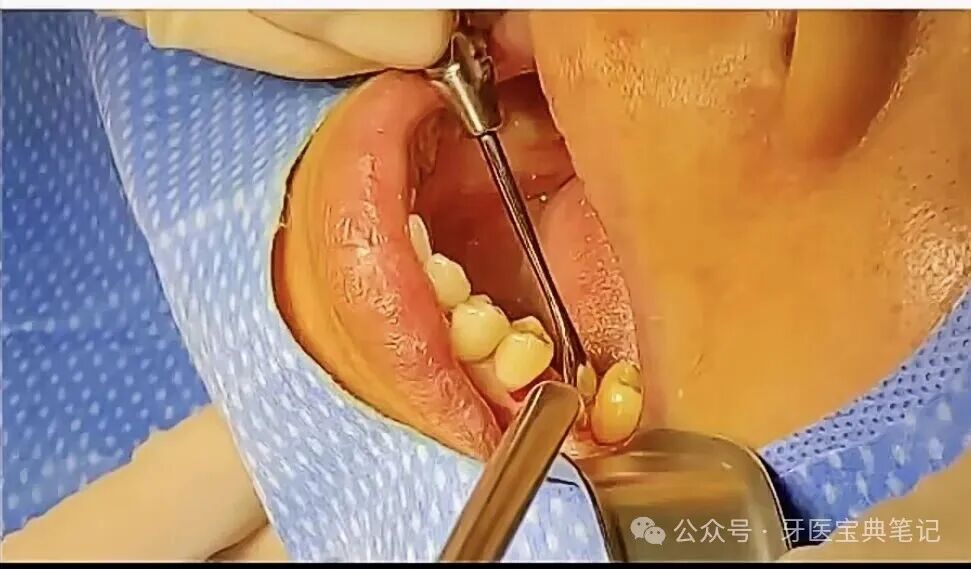 种植实操全流程！不再手忙脚乱～