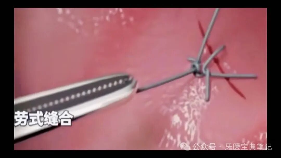 种植实操全流程！不再手忙脚乱～