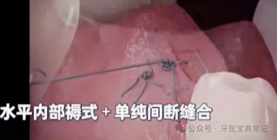 种植实操全流程！不再手忙脚乱～