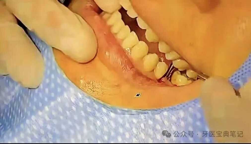 种植实操全流程！不再手忙脚乱～