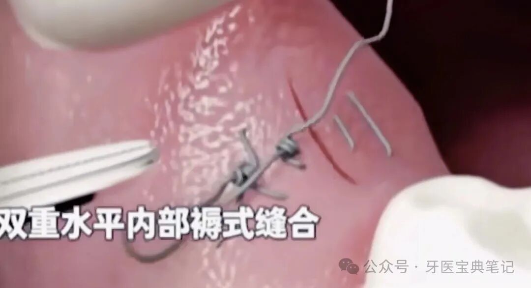 种植实操全流程！不再手忙脚乱～
