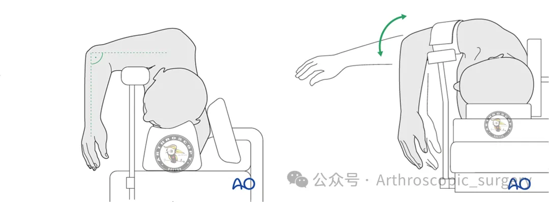 【手术技术】肘关节镜手把手教学