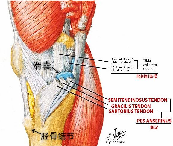 直击不明内侧膝痛——鹅足滑囊炎！