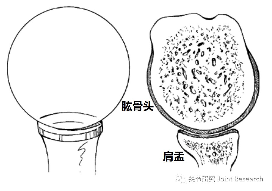 五分钟全面掌握：最容易被忽略的肩关节疼痛-盂唇损伤！