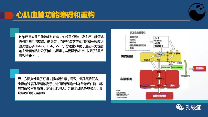 关于射血分数保留心衰的认识及困惑