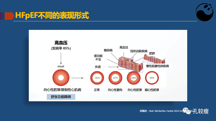 关于射血分数保留心衰的认识及困惑