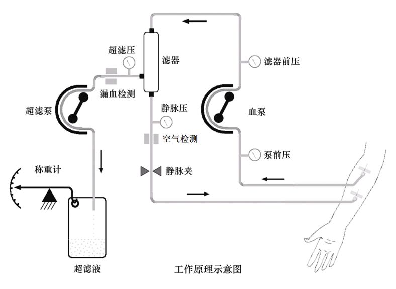 关于急性心衰的三大热点问题，你都掌握了吗？