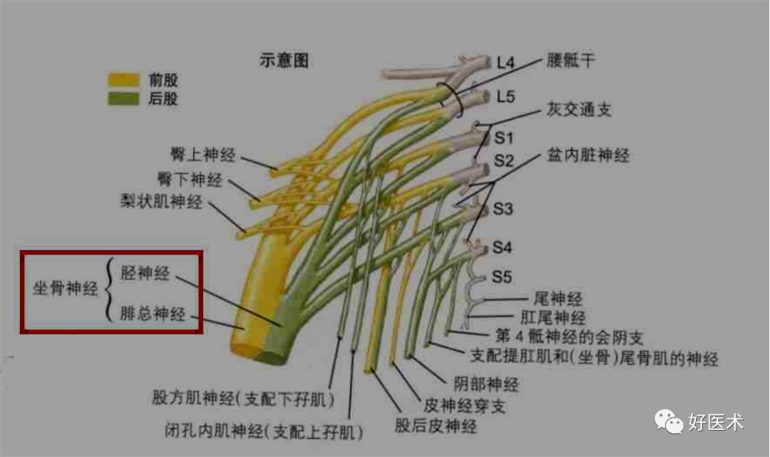 图文详解梨状肌综合征MR表现及诊治技巧，值得推荐！