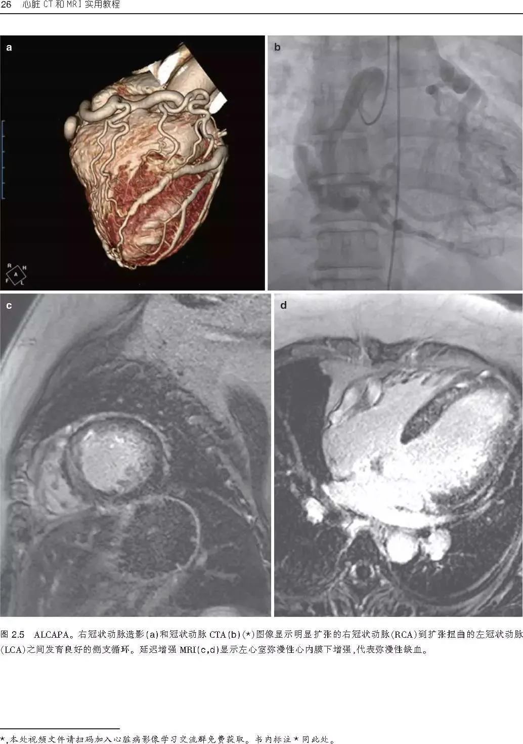新书首发：一本心脏CT和MRI影像学临床实用参考书，为心脏疾病诊断治疗提供新的方法！