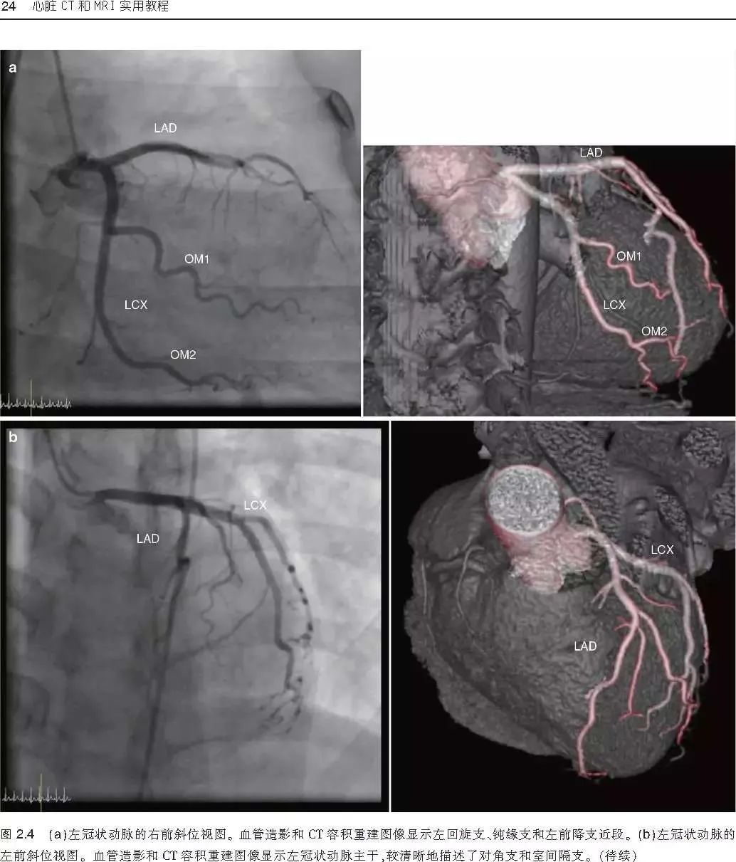新书首发：一本心脏CT和MRI影像学临床实用参考书，为心脏疾病诊断治疗提供新的方法！
