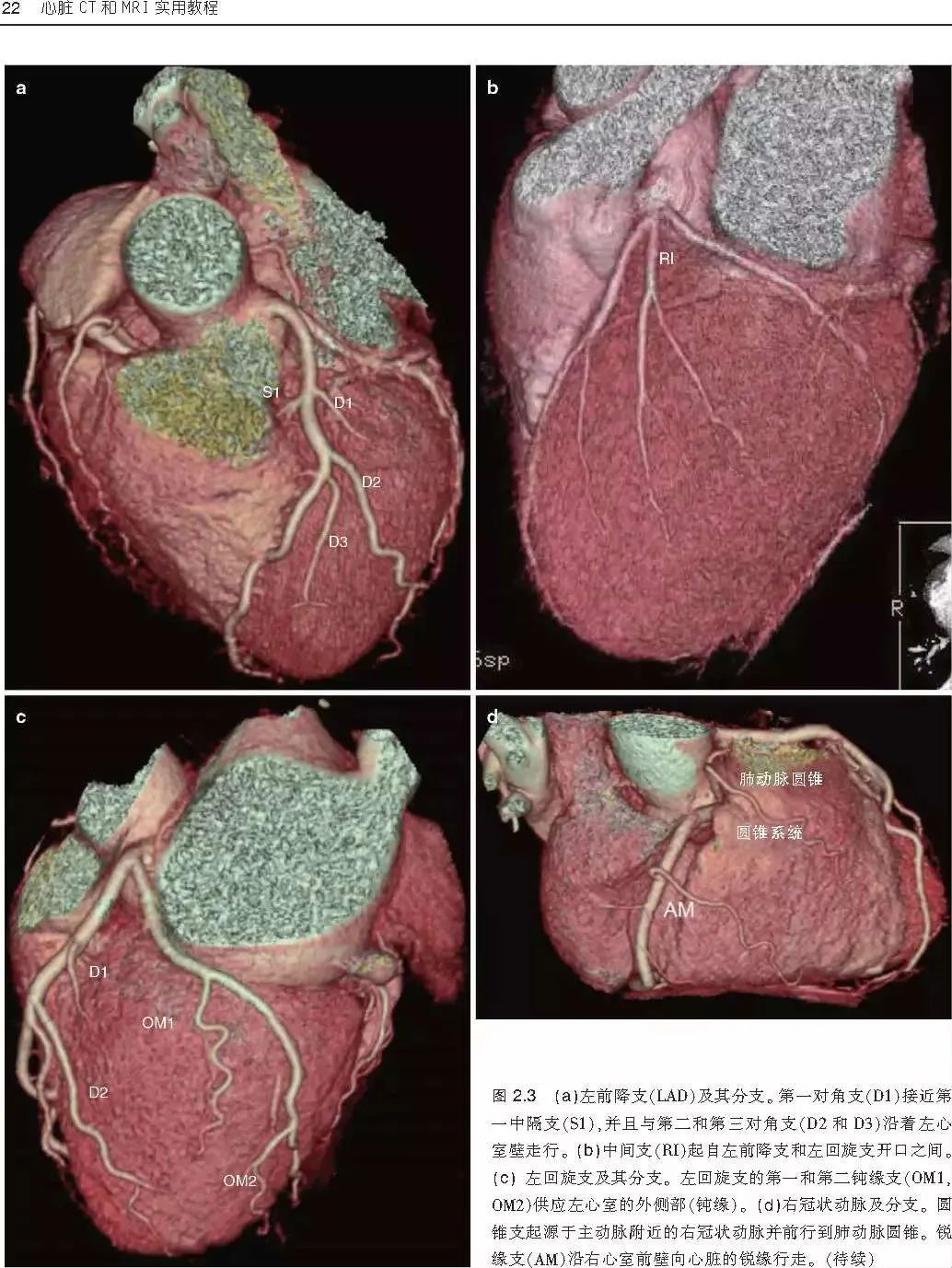 新书首发：一本心脏CT和MRI影像学临床实用参考书，为心脏疾病诊断治疗提供新的方法！
