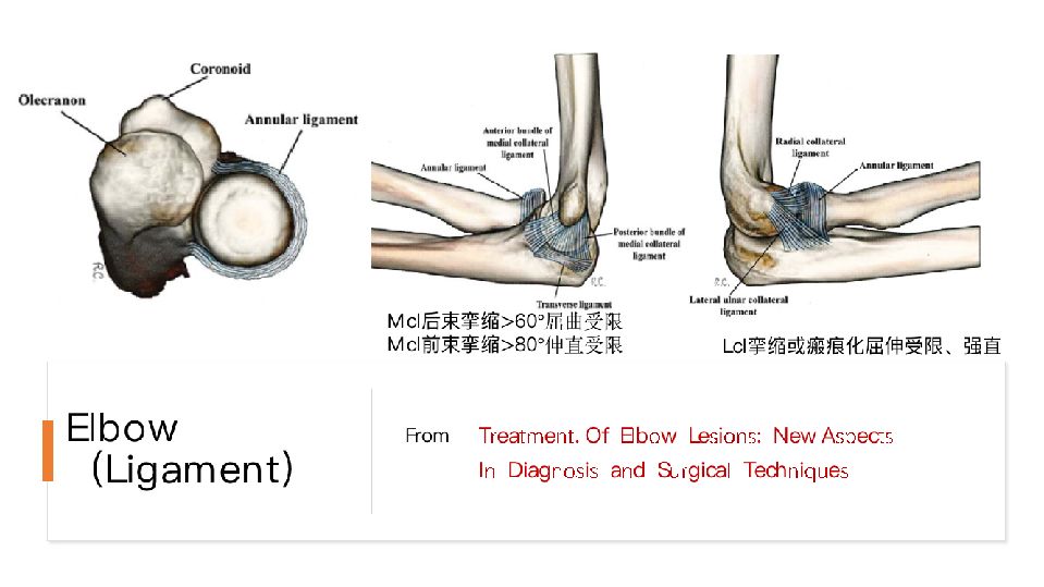 肘关节僵硬的个体化治疗选择，你弄懂了吗？