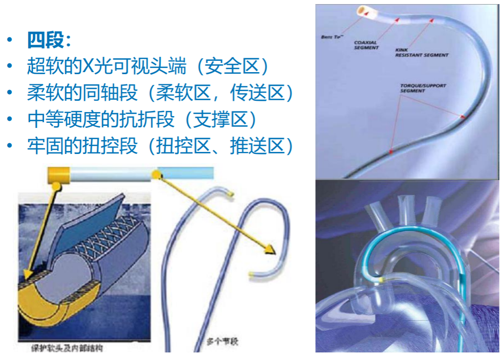 冠脉介入离不开的导管，你需要这篇文章！