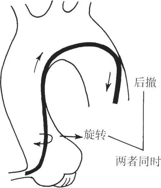 冠脉介入离不开的导管，你需要这篇文章！