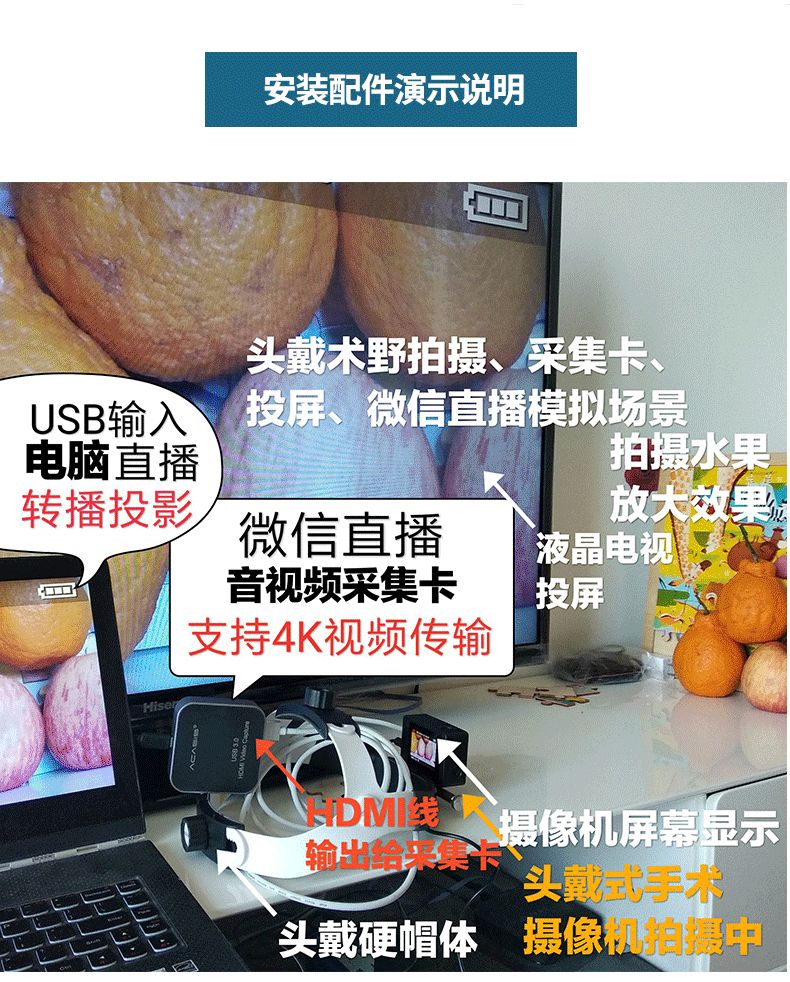 直降400元：GOPRO头戴式手术摄像机，周年庆重磅回馈！
