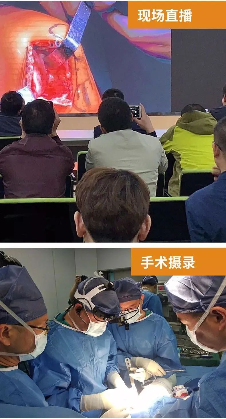 直降400元：GOPRO头戴式手术摄像机，周年庆重磅回馈！