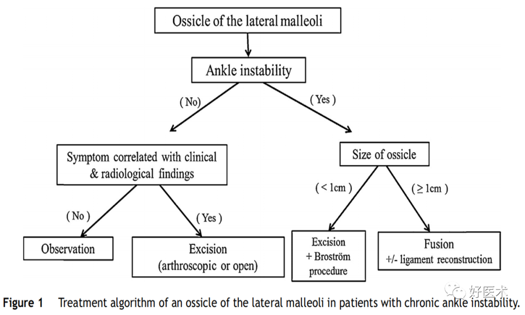 慢性外侧踝关节不稳的处理，速度查看！