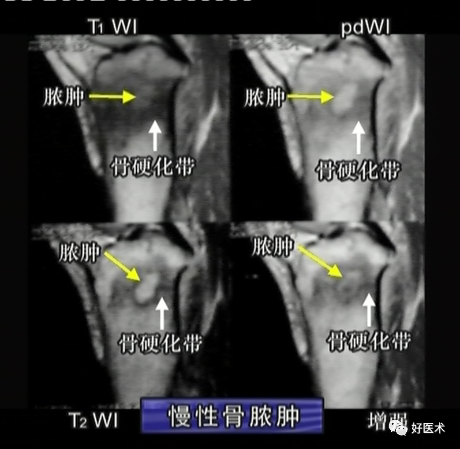 80%的MRI阅读难题，都可以被这篇文章化解！