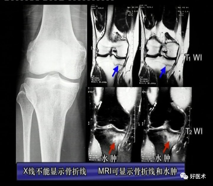 80%的MRI阅读难题，都可以被这篇文章化解！