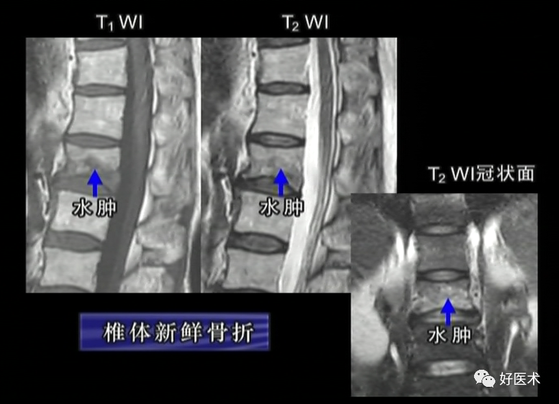 80%的MRI阅读难题，都可以被这篇文章化解！