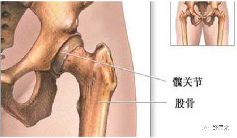 骨科必备局部解剖及手术入路，高清图文详解！