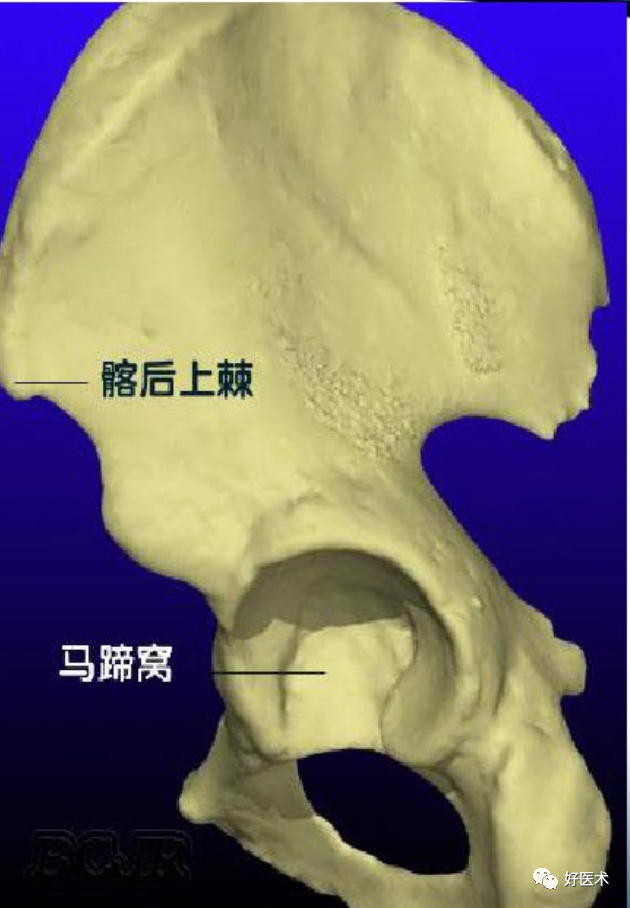 骨科必备局部解剖及手术入路，高清图文详解！