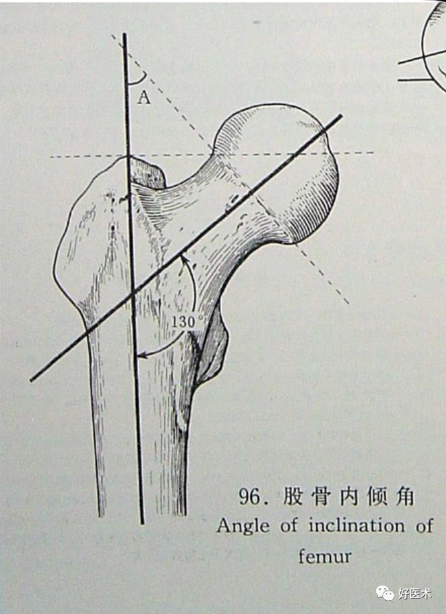 骨科必备局部解剖及手术入路，高清图文详解！