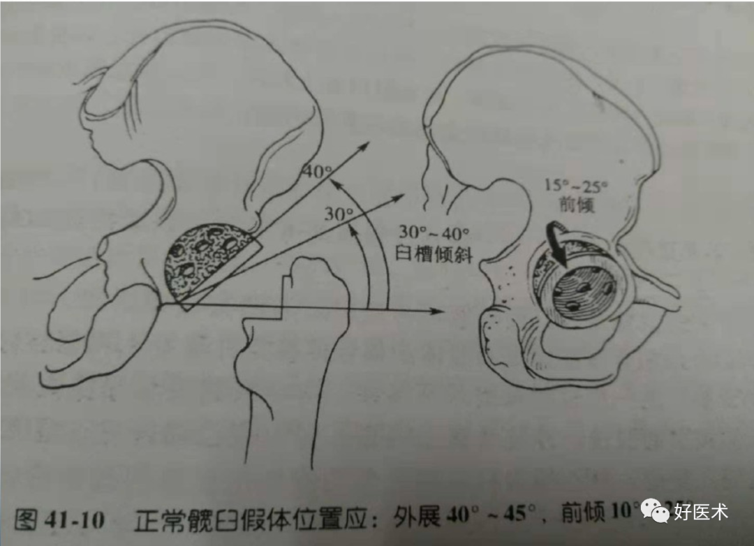 骨科必备局部解剖及手术入路，高清图文详解！