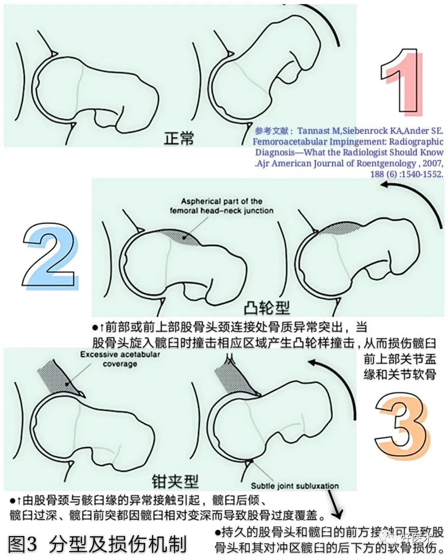 大腿根痛、小腿发软用不上力？14张高清图为你解答！