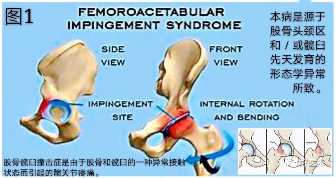 大腿根痛、小腿发软用不上力？14张高清图为你解答！