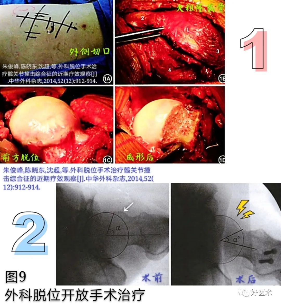 大腿根痛、小腿发软用不上力？14张高清图为你解答！