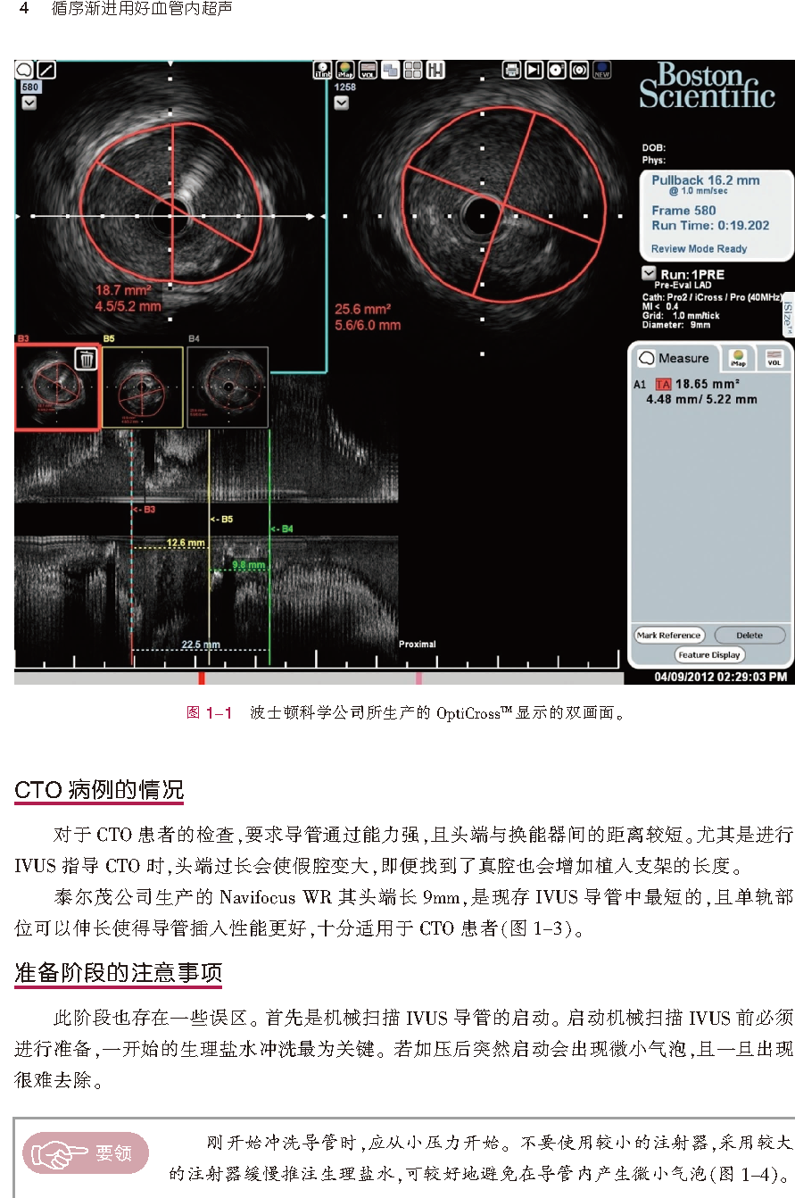 新书首发：用好血管内超声（IVUS），这本书可以教你更多小技巧！