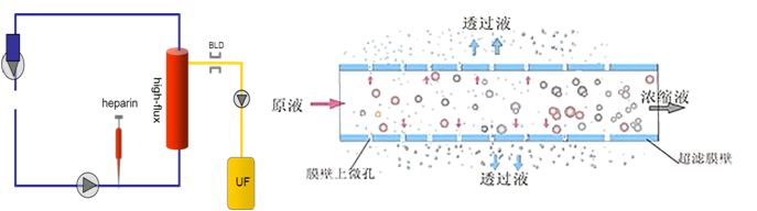 重症心衰患者的容量我们该如何管理？