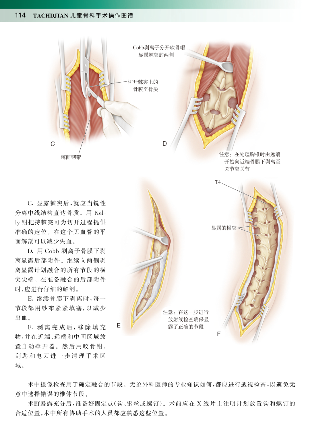 新书推荐：儿童骨科手术操作图谱，畅销48年的国际儿童骨科精华本