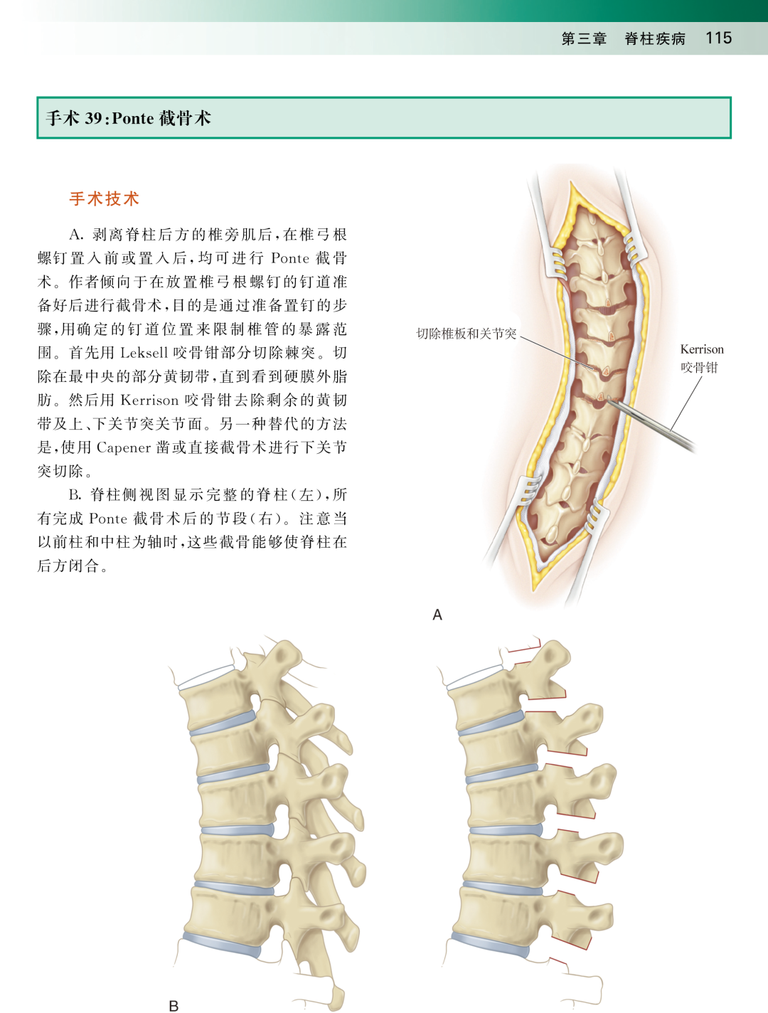 新书推荐：儿童骨科手术操作图谱，畅销48年的国际儿童骨科精华本