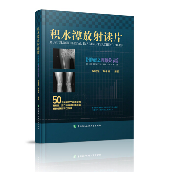 好书推荐：《积水潭放射读片-骨肿瘤之髋膝关节篇》，必备收藏！