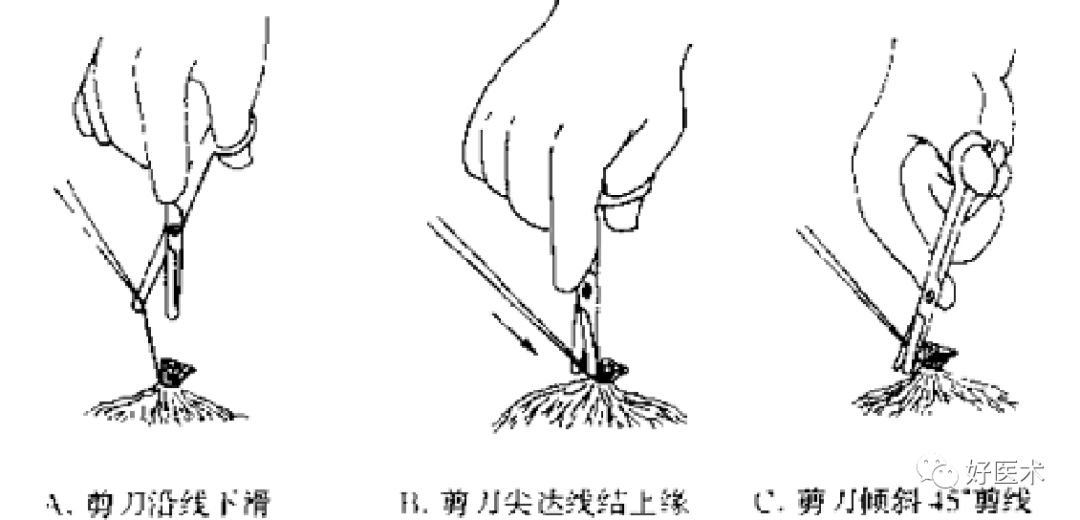 超实用：外科手术基本功速成法，书上学不到的秘诀！