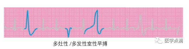 学习心电图必须掌握的基础知识，收藏起来慢慢看！