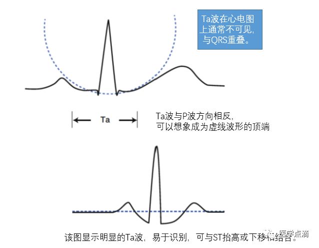 学习心电图必须掌握的基础知识，收藏起来慢慢看！