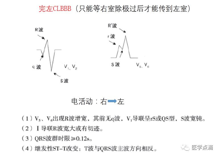 学习心电图必须掌握的基础知识，收藏起来慢慢看！