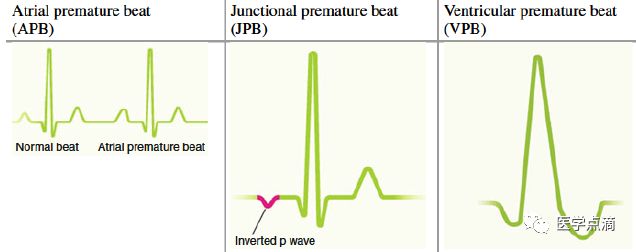 学习心电图必须掌握的基础知识，收藏起来慢慢看！