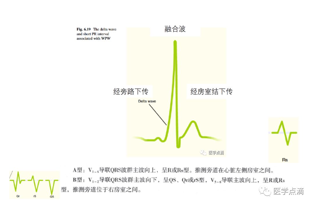 学习心电图必须掌握的基础知识，收藏起来慢慢看！