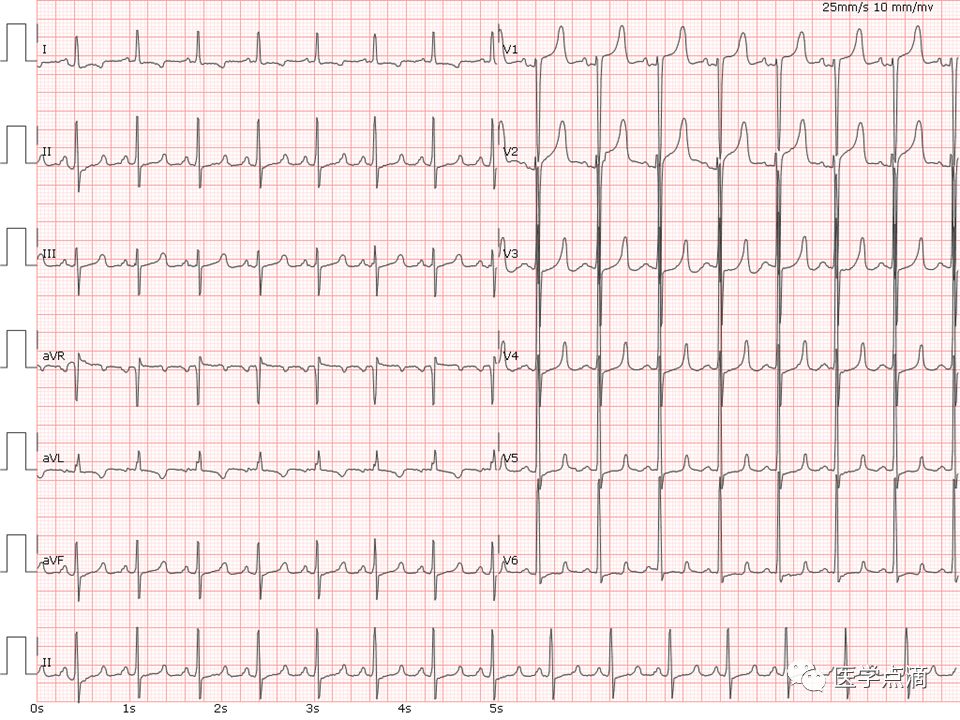学习心电图必须掌握的基础知识，收藏起来慢慢看！