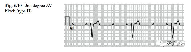 学习心电图必须掌握的基础知识，收藏起来慢慢看！