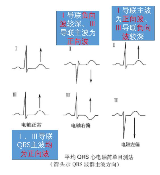 学习心电图必须掌握的基础知识，收藏起来慢慢看！