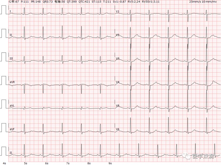 学习心电图必须掌握的基础知识，收藏起来慢慢看！