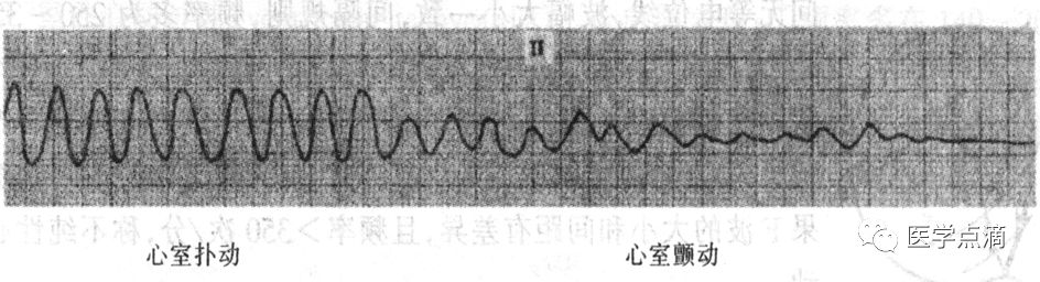 学习心电图必须掌握的基础知识，收藏起来慢慢看！