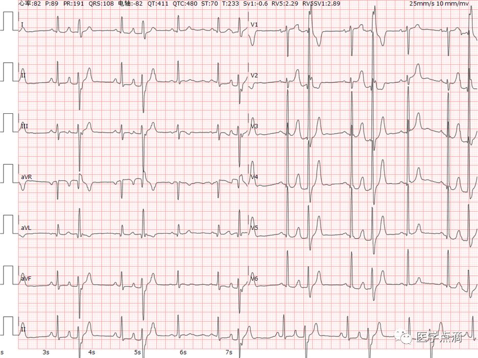 学习心电图必须掌握的基础知识，收藏起来慢慢看！